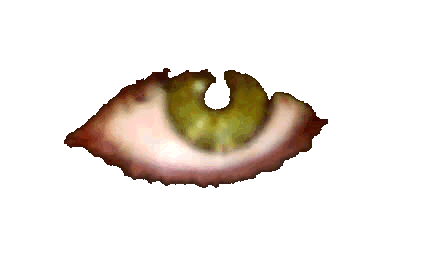eye